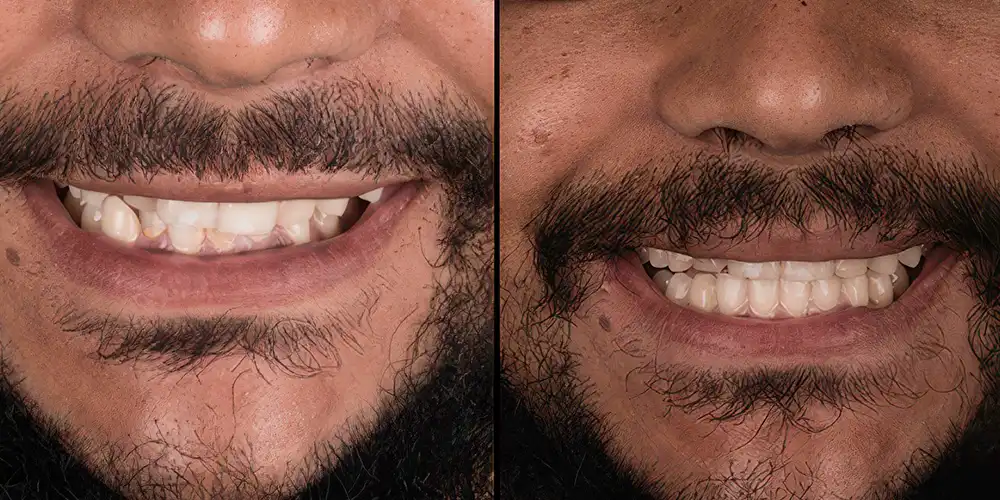 Mia Healthcare Orthodontics