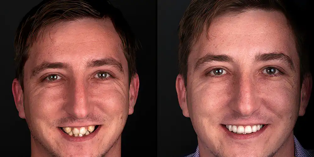 Mia Healthcare Orthodontics