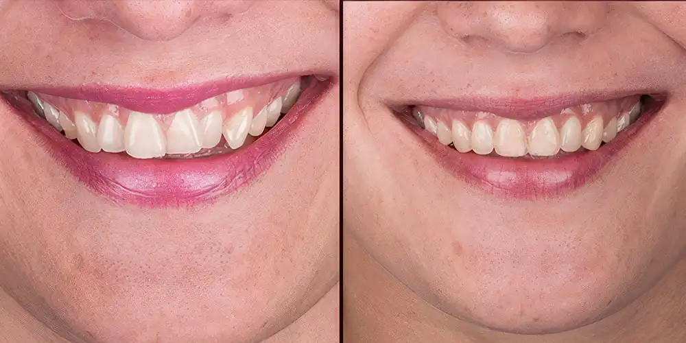 Mia Healthcare Orthodontics