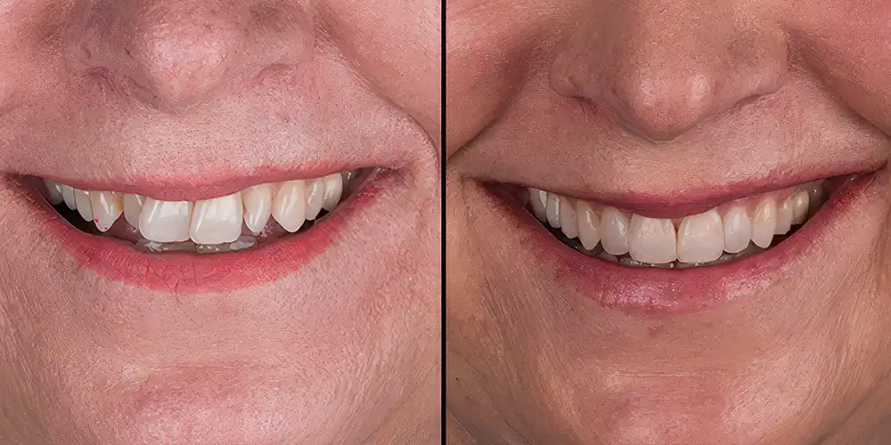 Mia Healthcare Orthodontics