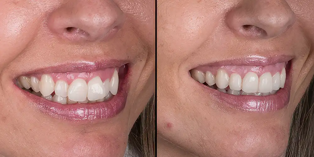 Mia Healthcare Orthodontics